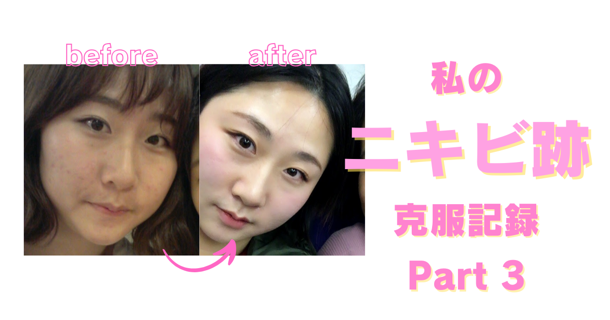 空極のスキンケア方法의 사본
